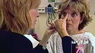 See My Results from Non Surgical Laser Facelift