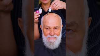 Makeover ✨ Journey: Alopecia to Confidence Transformation #makeover #newlook #shorts