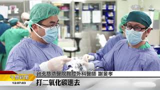 食道腫瘤8公分 首例單孔縱膈腔鏡