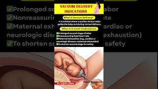 Vacuum Birth? Here’s What Really Happens During Delivery | Vacuum Delivery in Childbirth