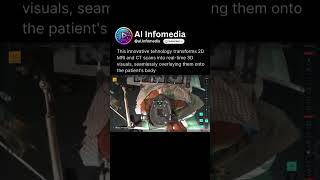 How Medivis AR is Transforming Surgery with Augmented Reality! #surgeryreview #medtechinnovation