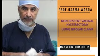 NDVH  USING BIPOLAR CLAMP- O WARDA