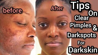 Clear pimples and darkspots With My morning and night simple skincare routine !