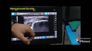 Suffering from heel pain?
