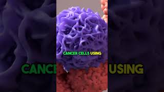 Understanding Fatigue and Weakness in Cancer: Impact on Daily Life #shorts #kidneycancer