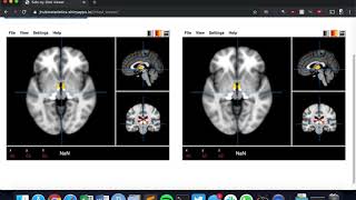 2 Linked Papaya Viewer Shiny app