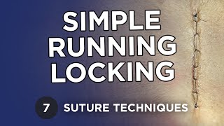 Simple Running Locking Suture - Learn Suture Techniques