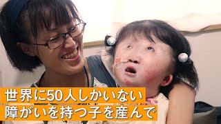 【「こんなかわいい子はいない」】世界的に稀少な染色体異常を持つ子と生きるお母さんの一日 supported by にしたんクリニック #にしたん ARTクリニック #共生社会 #障害 #障がい