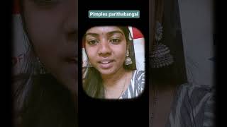 Pimples parithabangal #rjmadhu #hellofm #tamilfm #shorts #youtubeshorts #viral
