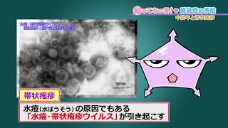 【中高年の感染症】帯状疱疹(たいじょうほうしん)とは「知ってなっ得！感染症の予防＃９その３」