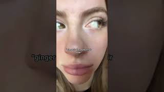 Is Ginger hair ugly? #ginger #redhead