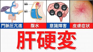 【20分で解説、40分で国試問題】肝硬変について解説