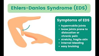 Ehlers Danlos syndromes EDS Nrf2 and collagen discussion