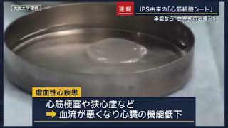 心臓手術・心筋細胞シート