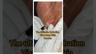 Benefits of skin booster - #viscoderm #rajahmundry #skincare