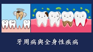 (國語)一牙周病與全身性疾病(口腔系列之二)