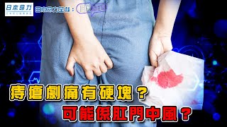 痔瘡劇痛有硬塊？可能係肛門中風？ ｜ 日本命力呈獻: 健康關注組 ｜ EP396 ｜ 血栓性痔瘡 ｜ 肛門中風 ｜ 吳雲甫 ｜ 麥詩敏 ｜ HOY TV 77台