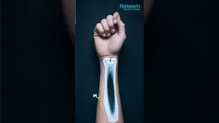 Joint Pain? Get Moving Again! Expert Orthopedic Care in Al Khor