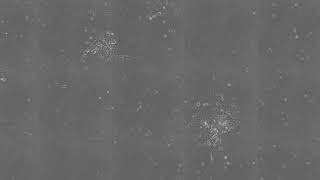 血液の細胞からiPS細胞ができてくる様子/Reprogramming to iPSCs from human blood cells.