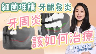 🤓您知道什麼是牙周病嗎？EP.8 台中牙科陳怡蓉醫師小學堂來跟大家科普何謂牙周病💕 #牙周病 #牙周炎 #牙齦發炎 #口臭 #牙菌斑
