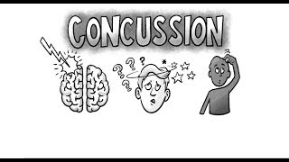 What is a concussion?