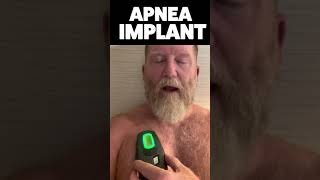 ⚡️Inspire Sleep Apnea Implant Activation By Doug #shorts⚡️
