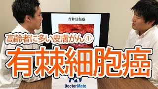 高齢者に多い皮膚がん① 有棘細胞癌