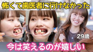 【全部見せます】セラミックブリッジでここまで改善されたボロボロでガタガタの歯