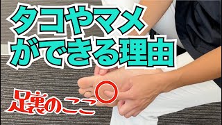 足裏にタコやマメができる原因と治し方　｜京都市北区　もり鍼灸整骨院