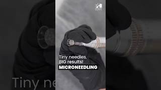 Microneedling | PHI Clinic #phiclinic #skincaretreatment #haircaretreatment #microneedlingtherapy