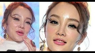 女星整容後臉歪嘴斜！蕭薔變成塑膠臉很正常，但看到王心淩時，我簡直不敢直視！太可怕了！ | 365day 娛樂新聞