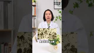 只有柳絮纷飞时候发作的鼻炎是过敏性鼻炎吗？【鼻炎】 #shorts #shortvideo