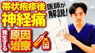 帯状疱疹後神経痛（たいじょうほうしんごしんけいつう）の発生する原因とその痛みに関する治療を医師が解説！