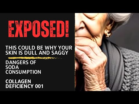 YOU ARE AGING FASTER BECAUSE OF SODA/that's why they keep selling cheap. #collagenfail #skincarefood