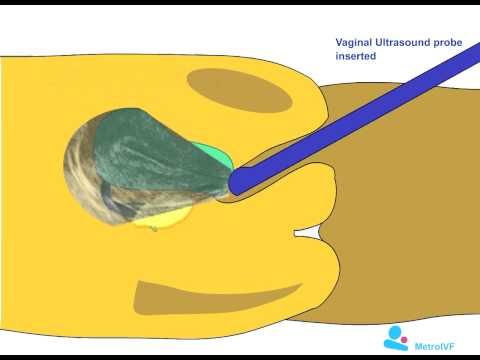 follicle tracking music