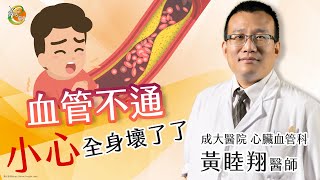 【成大醫院】成大e學堂 【周邊動脈血管阻塞疾病】 心臟血管科  黃睦翔醫師