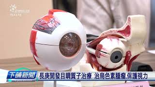 長庚開發眼部質子治療 治黑色素腫瘤保護視力 | 每日新聞的部分 | 台語台新聞 | 20230202