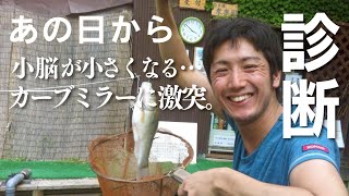【難病】診断の詳細をお話しします・脊髄小脳変性症