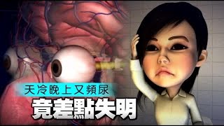 女子夜尿爆血管 罹眼中風 | 台灣蘋果日報