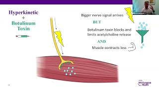 Botulinum Toxin (Botox) Treatment for Movement Disorders
