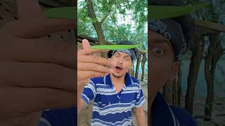 “Worst. Hangnail. Ever! 🤮😂 You’ve Been Warned — Not for Mealtime!” #funny #wacky #funnypost