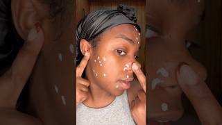 ACNE begone! #acnefree #blemishes