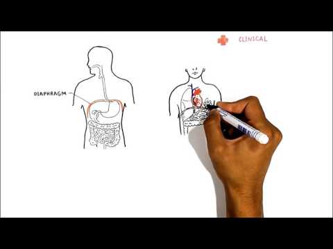 The Stomach