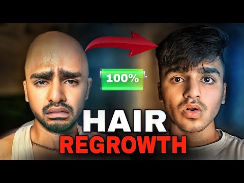 How to stop HAIRFALL | Hair regrowth 100% POSSIBLE | @raghavpills