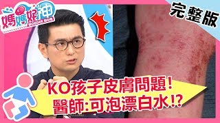 「漂白水」治異位性皮膚炎超有感？3要點對抗小孩肌膚警訊！【媽媽好神】20181029 一刀未剪版 EP338 黃小柔 黃瑄