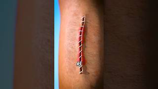 How Stitches Work and the Healing Process #shorts #stitches #how #process