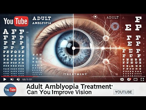 Adult Amblyopia Treatment।Previous vision Right Eye 6/18 & left Eye 6/36 after Therapy 6/6 Both Eye