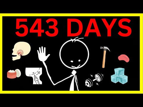 543 Days Of Looksmaxxing Taught Me This...