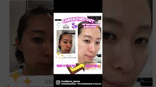 [BeforeandAfter]Read Description👇👇#kbeauty #skincare#transformation