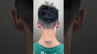 落枕 肌貼這樣貼#落枕 #物理治療 #頸痛 #脖子痛 #neckpain #discherniation #sternocleidomastoid #splenius #kinesiotape